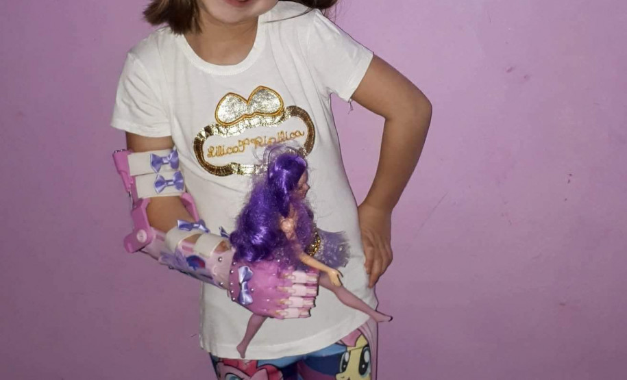 Os estudantes do curso técnico em Informática do Colégio Estadual Cristóvão Colombo, do município de Jardim Alegre, no Vale do Ivaí, iniciaram em 2017 o projeto Mão Amiga Prótese em 3D para confeccionar e doar próteses para portadores da Síndrome de Brida Amniótica ou amputação, para crianças e adultos.